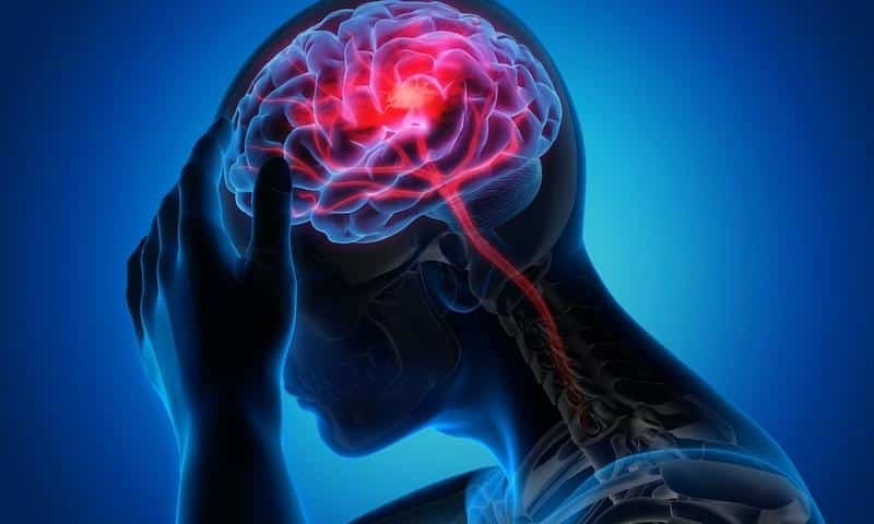 4 Proven Stress Reduction Techniques for Busy Professionals Battling Chronic Migraines